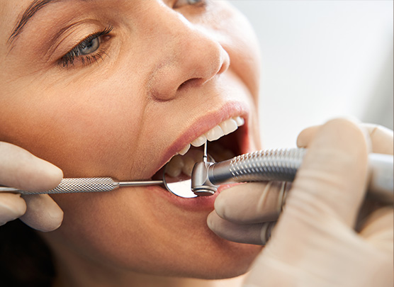 Drilling into patient tooth