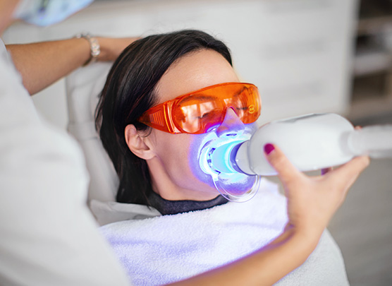 Woman undergoing tooth whitening procedure